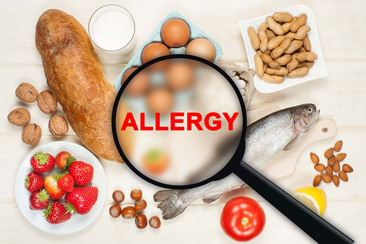 Allergic Sensitivity