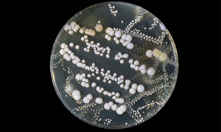 Bacteria and flora developing