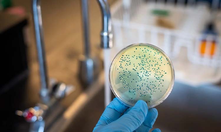 Microbial Contamination